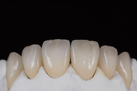 Dent 41