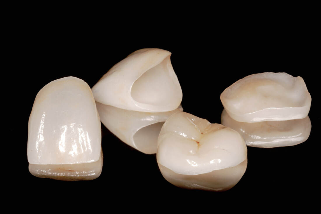 Dent 43