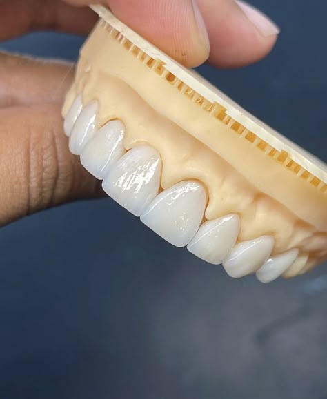 Dent 45