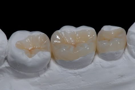 Dent 46